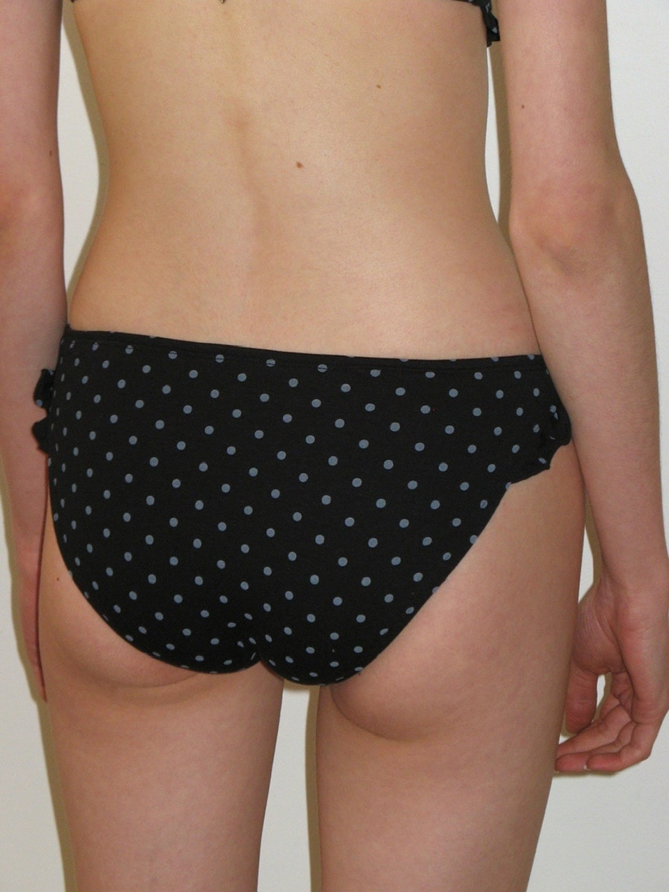 【CRANK】DOT FRILL BIKINI SET